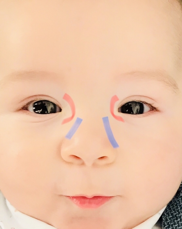 Massagem de rebarbas oculares em bebês