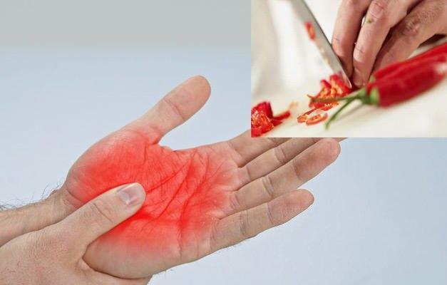 como se livrar da dor de pimenta na mão
