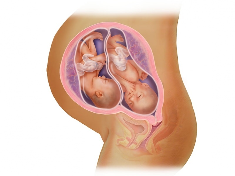 Gravidez gêmea em fertilização in vitro! O que é transferência de embriões?