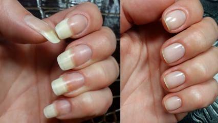 Como cuidar das unhas? Métodos rápidos de extensão de unhas