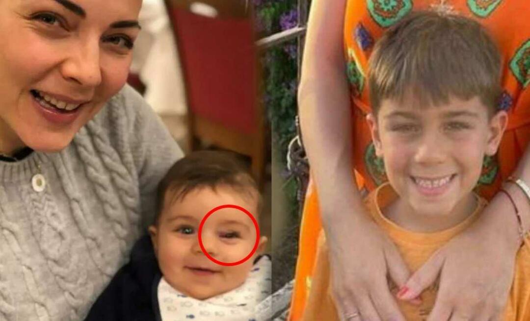 Burcu Kara anunciou a doença do filho! O inchaço no olho é sinal de tumor...