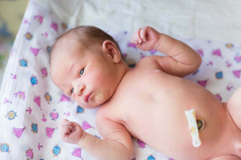 Corte tardio do cordão umbilical em bebês