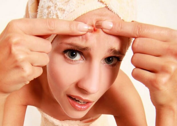 A acne causa dores de cabeça? O que fazer contra a acne dolorosa? Dor de acne ...