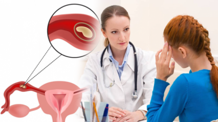 O que é gravidez ectópica (gravidez ectópica), por quê? Quais são os sinais da gravidez ectópica?