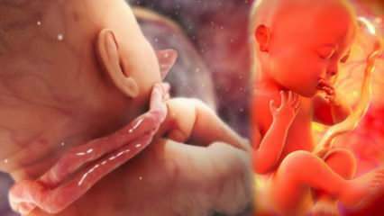 O que é emaranhado de cordão? Cordão emaranhado ao redor do pescoço do bebê no útero da mãe