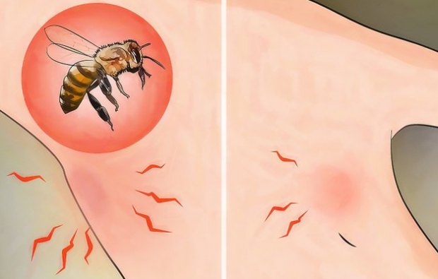 O que é alergia a abelhas e quais são os sintomas? Métodos naturais que são bons para picadas de abelha