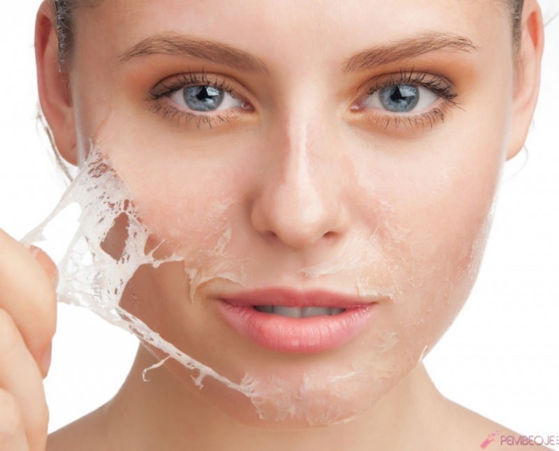 O que é bom para descamação da pele e como é a descamação da pele? Remédio caseiro para descamação da pele