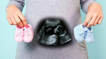 O sexo do bebê será determinado no primeiro trimestre da gravidez?