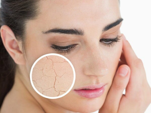 Por que a pele seca? O que fazer na pele seca? As recomendações de cuidados mais eficazes para a pele seca