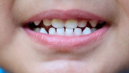 Como ensinar atendimento odontológico às crianças?