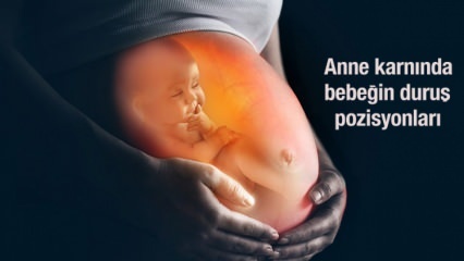 As posições posturais do bebê no ventre da mãe! Como entender a posição do bebê? Para o canal de parto ...