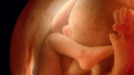 Não mostrar o sexo do bebê na ultrassonografia! Como os meninos e meninas ficam no ultrassom?