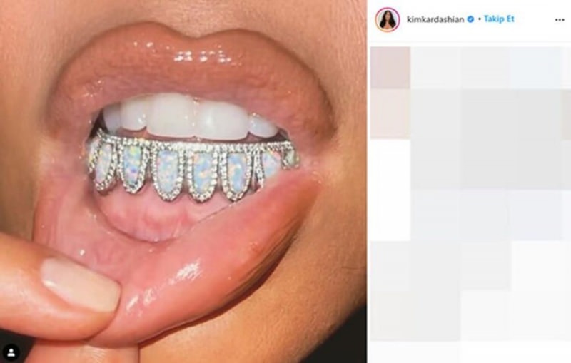 Joia dentária de $ 5.000 de Kim Kardashian
