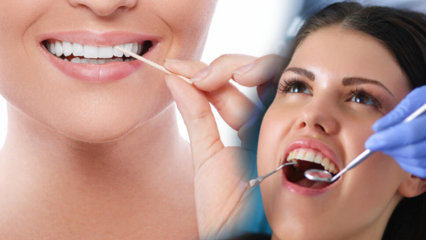 Como manter a saúde bucal e dentária? O que deve ser considerado ao limpar os dentes?