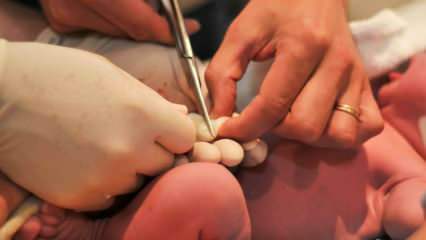 Quando o cordão umbilical é cortado em bebês? Benefícios do corte tardio do cordão umbilical