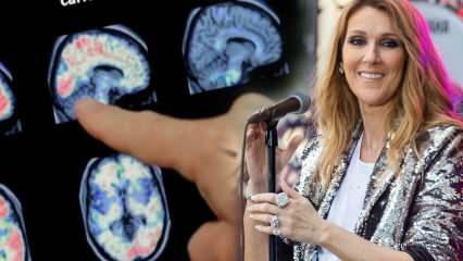 O que é a síndrome da pessoa rígida? Celine Dion