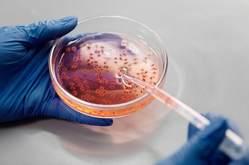 Quais são os sintomas do estresse oxidativo