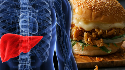 Em quais alimentos a gordura trans existe? Doenças causadas por gordura trans ...