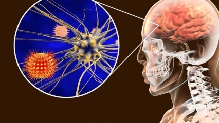 O que é meningite e quais são os sintomas? Existe tratamento para meningite?