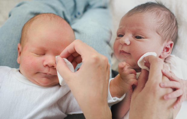 Como é a rebarba dos olhos nos bebês?