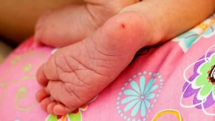 Por que o sangue do calcanhar é coletado em bebês? Requisitos para análises ao sangue do calcanhar em lactentes