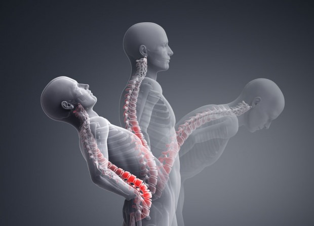 O que é uma fratura de colapso da coluna vertebral? Como é o tratamento da fratura do colapso da coluna vertebral?