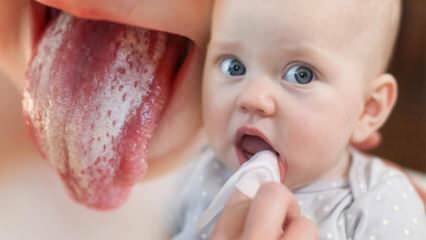 Sintomas e tratamento de aftas em bebês! Como é sapinho em bebês?