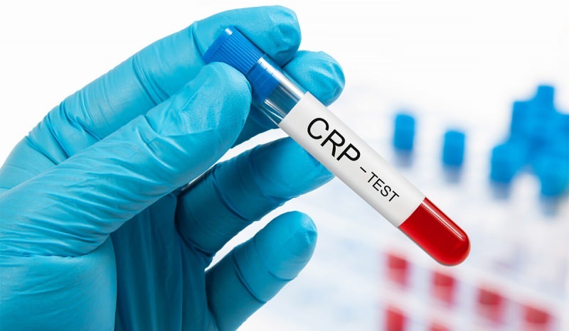Por que a CRP no sangue aumenta? O que é CRP? Como diminuir o CRP?