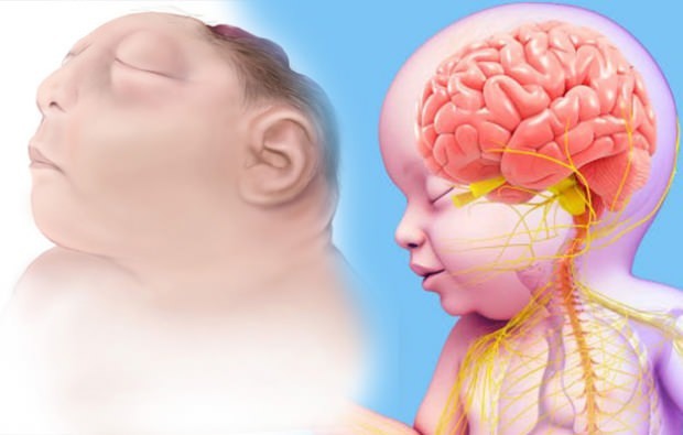 O bebê Anencefalia vive? Diagnóstico de anencefalia
