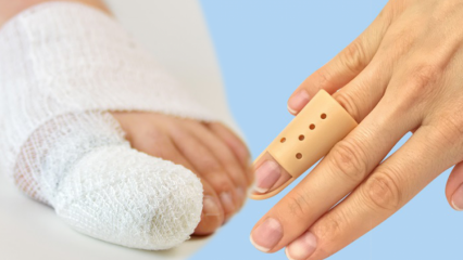 O que causa a quebra dos dedos? Quais são os sintomas da quebra dos dedos?