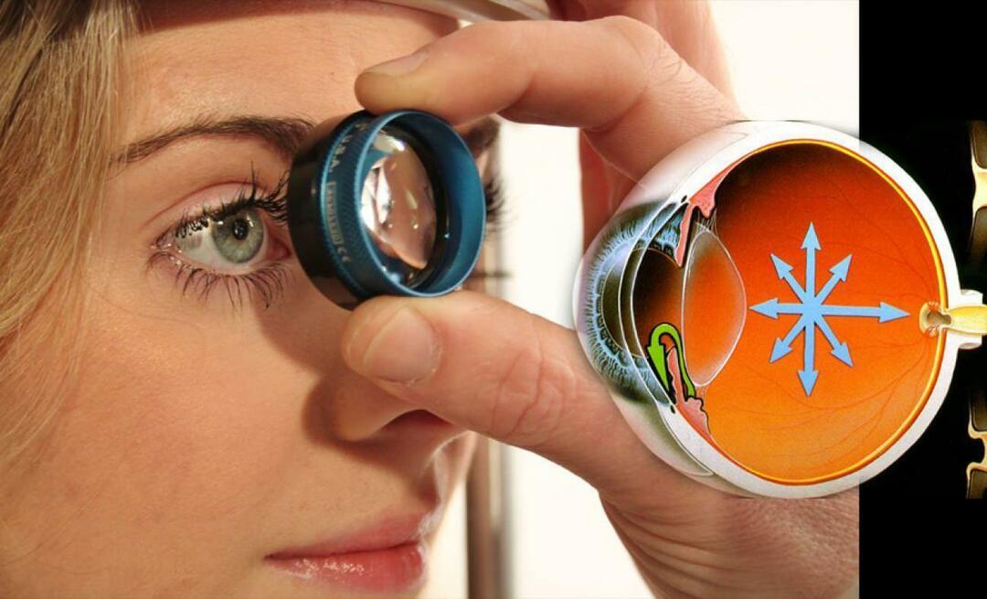 O que é glaucoma? Preste atenção nessa doença que avança insidiosamente sem dar nenhum sintoma!