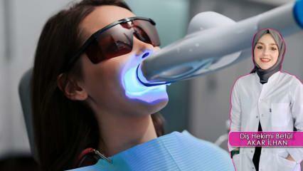 Como é feito o método de clareamento dental (Bleaching)? O método de clareamento danifica os dentes?