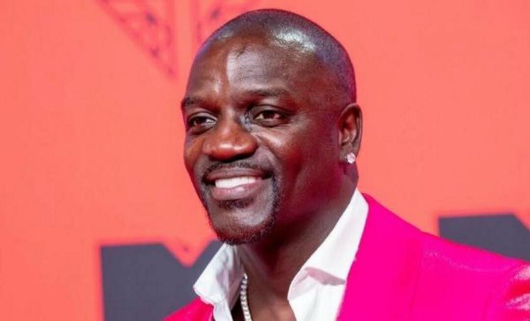 O cantor americano Akon também preferiu a Turquia para transplante de cabelo! Aqui está o preço que ele pagou...