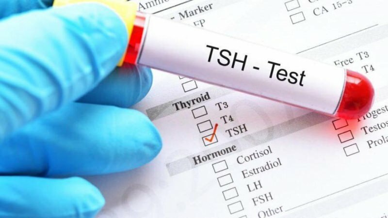 teste tsh é um teste de hormônio