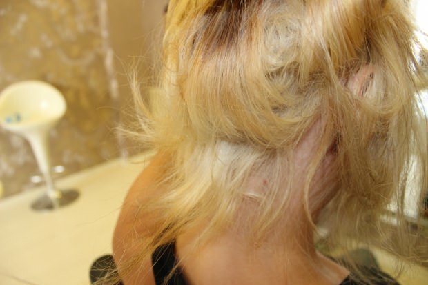 O que é feito para queimar o cabelo do meio? Como o cabelo tratado deve ser mantido?