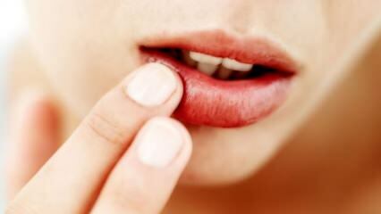 O que é bom para estalar os lábios?