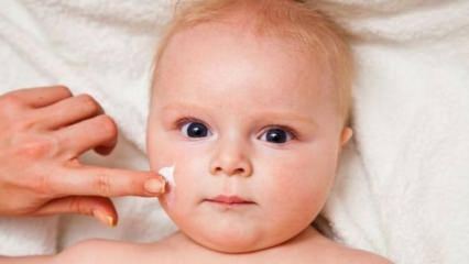 Dicas de cuidados com a pele para bebês! Quais são os problemas de pele em bebês?