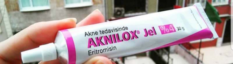 O que o Aknilox Gel faz? Como usar o Aknilox Gel? Qual o preço do Aknilox Gel?