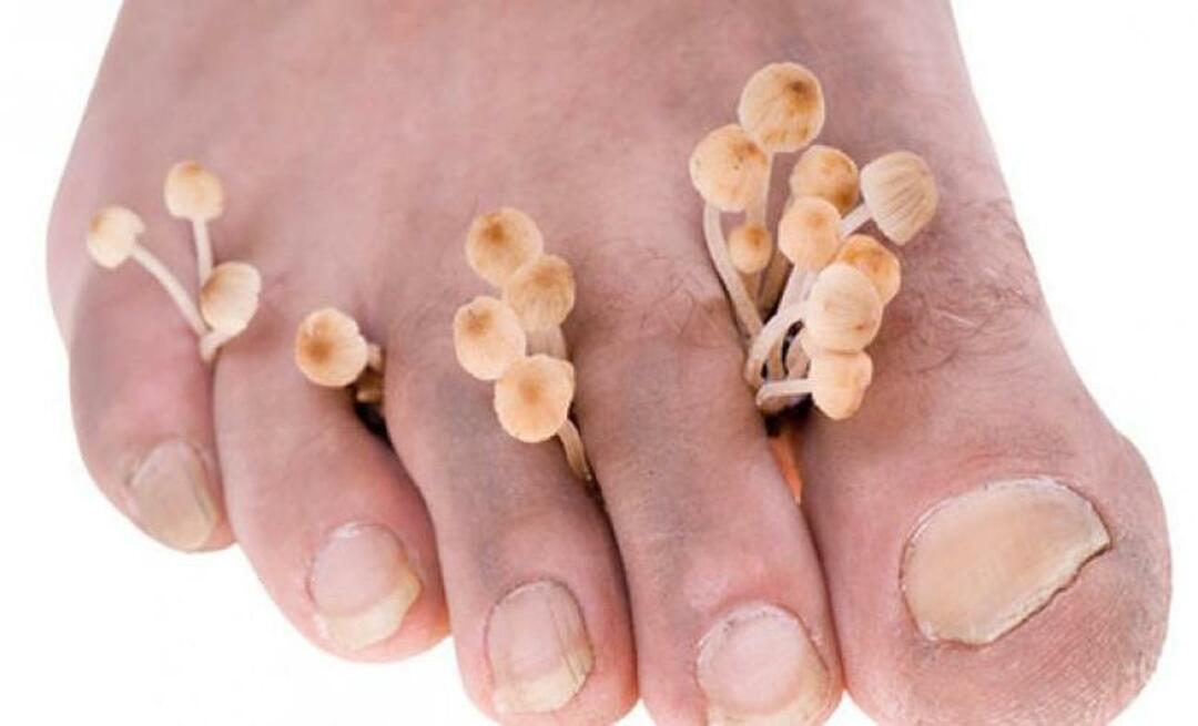 Como o fungo nos pés é transmitido?