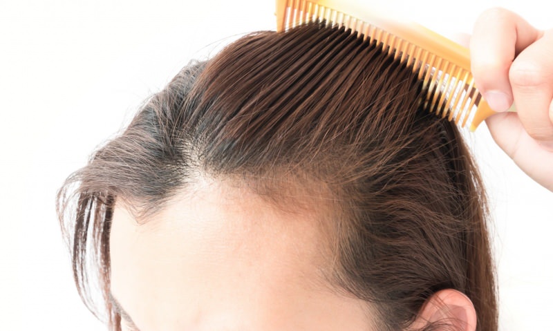 soluções para perda de cabelo após o parto! O que é bom para a perda de cabelo?