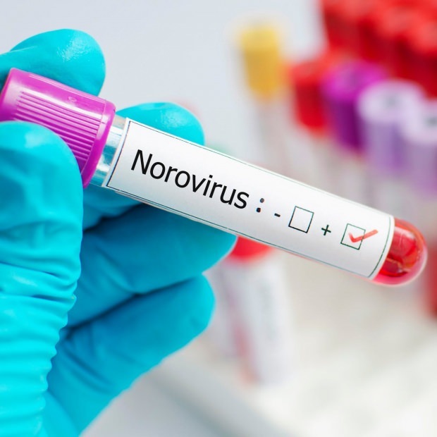 O que é norovírus e que doenças causa? Desconhecido sobre a infecção pelo Norovirus ...
