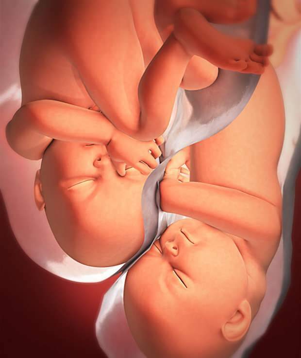 Quais são os sintomas da gravidez gemelar?