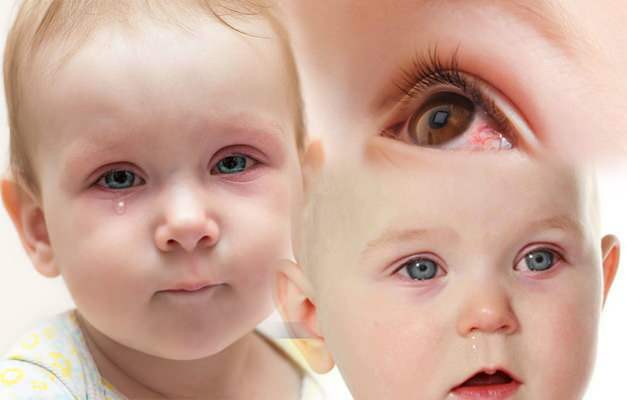 causa sangramento ocular em bebês