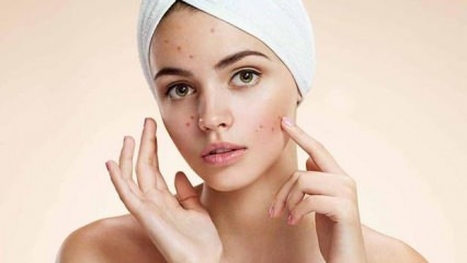 Os comprimidos para acne são prejudiciais?