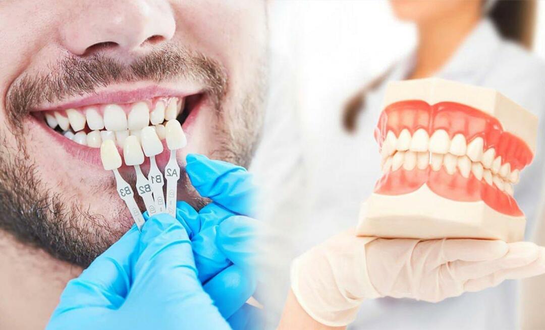 Por que facetas de zircônio são aplicadas nos dentes? Qual a durabilidade do revestimento de zircônio?