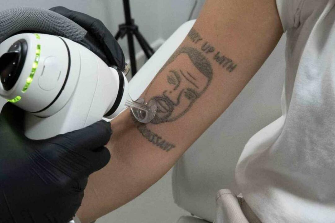 Atendimento gigante pra quem não gosta do Kanye West! A oportunidade de remover sua tatuagem de graça fez uma bagunça