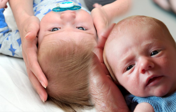 Como deve ser o formato da cabeça nos bebês?