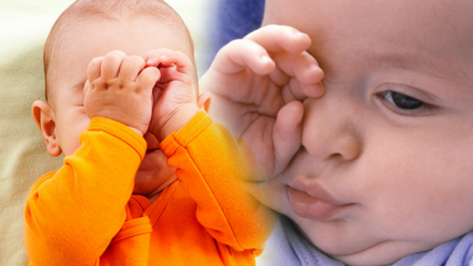 Soluções naturais para queimaduras nos olhos em bebês