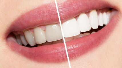 Quais são as recomendações para dentes brancos? Dente branqueamento cura naturalmente em casa ...