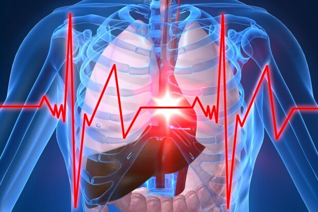 quais são os sintomas de um ataque cardíaco